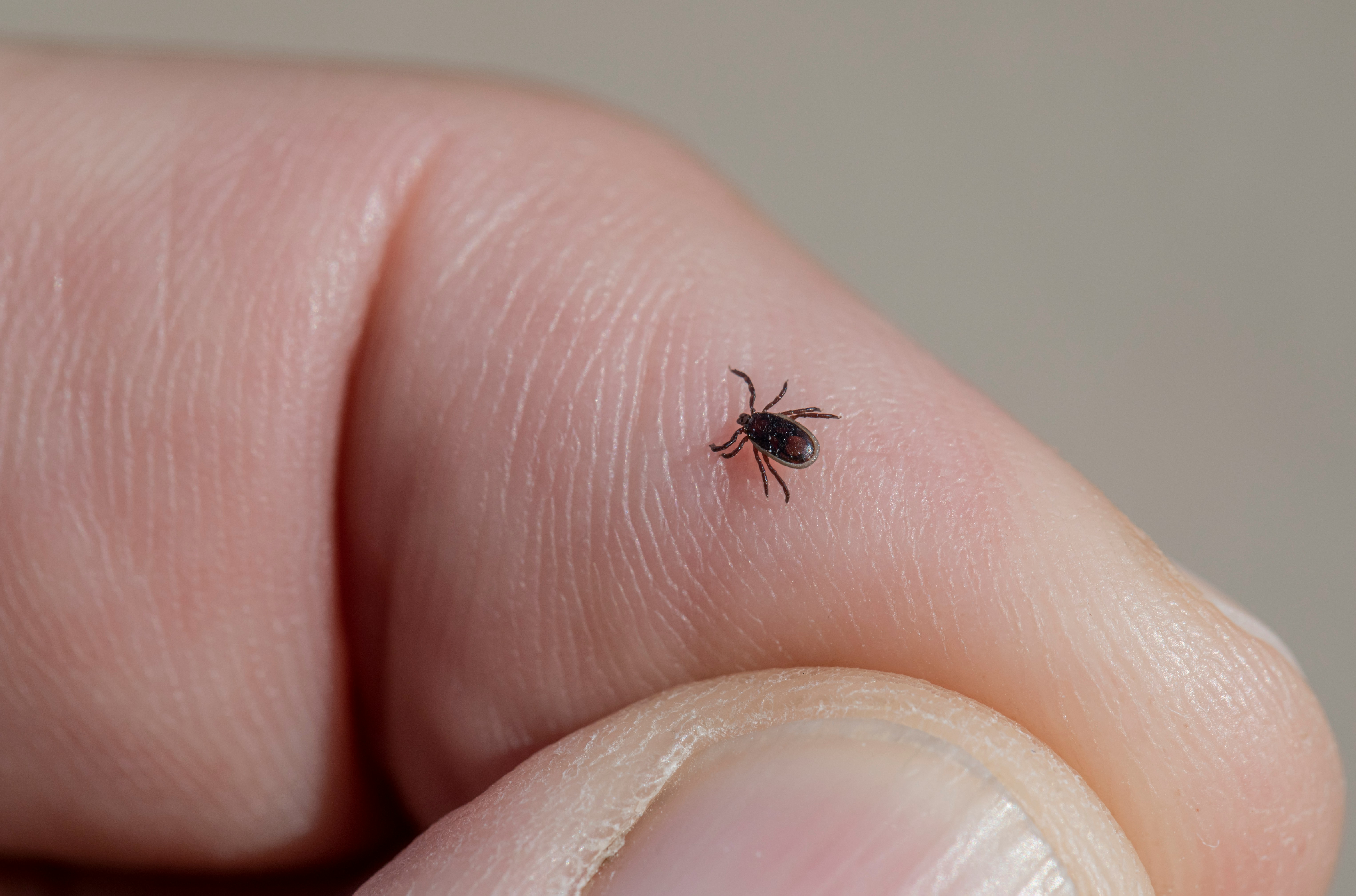 Tick on finger image